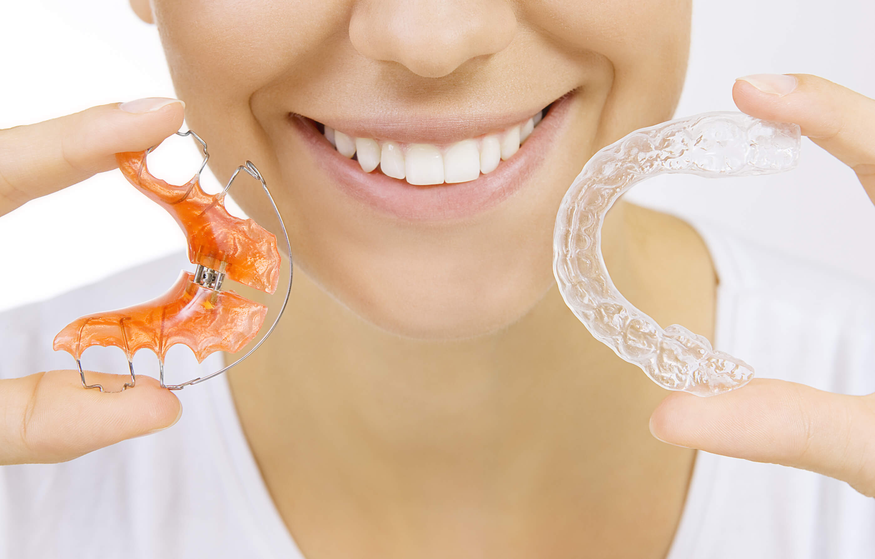 DSS aligners®